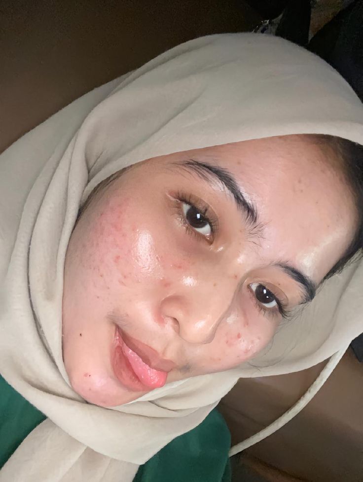 ABG Viral Hijab Abg 2025 Terbaru Indo Yang Masih Gurih Dan Kriuk Jadi Pusat Icikiwir Global Trending Top New